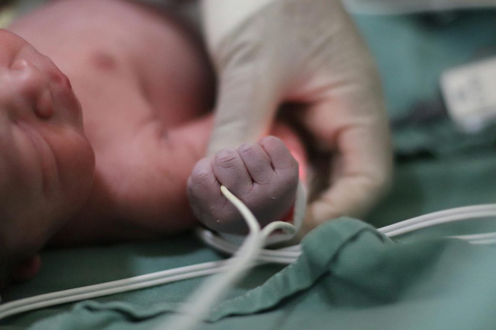 Miracle in Lucknow: Army Docs Save 9-Month-Old from LED Bulb Lung Nightmare